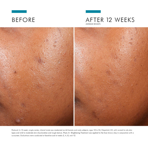 Before and after comparison of SkinCeuticals Phyto A+ Brightening Treatment Moisturizer on a brown background
