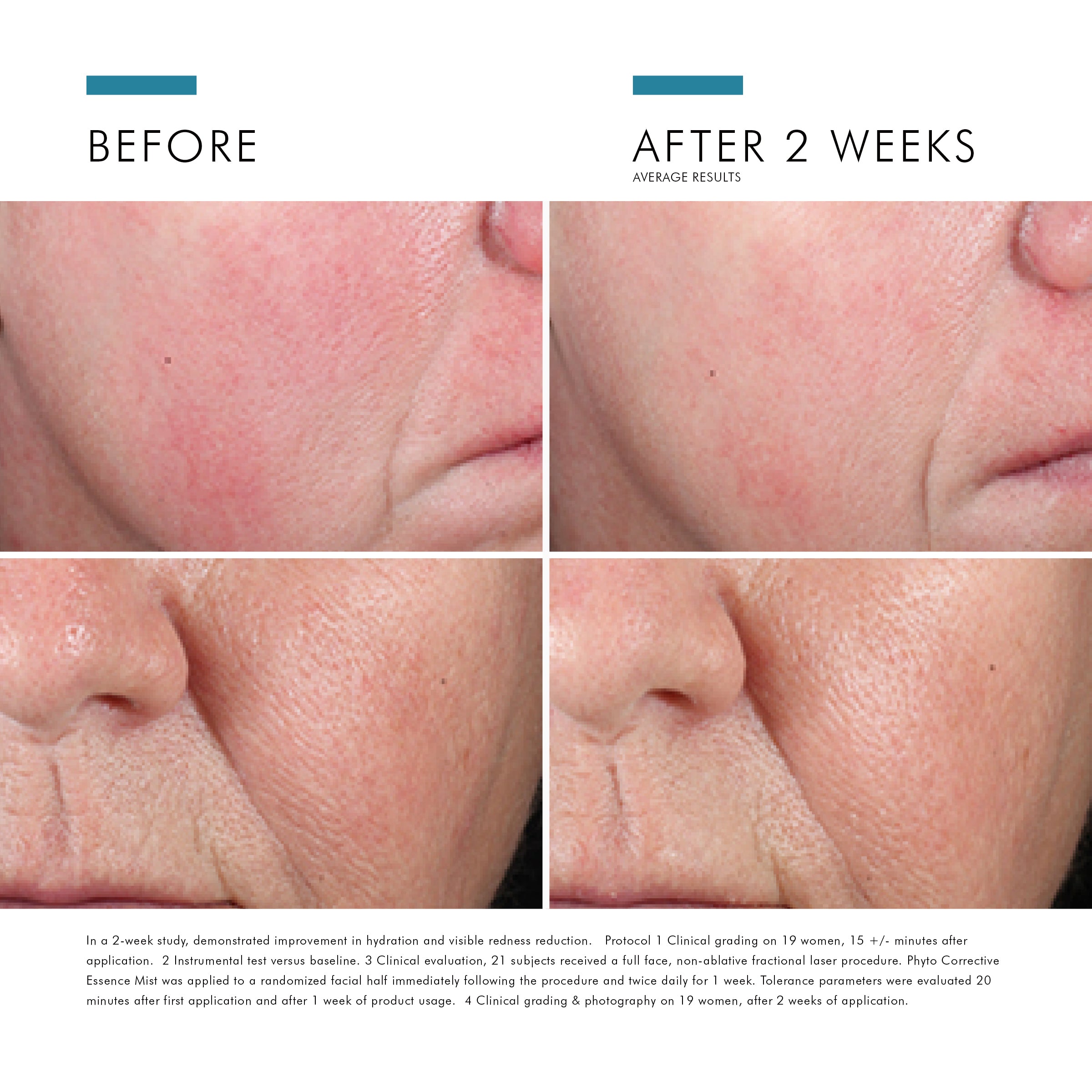 Before and after comparison of SkinCeuticals Phyto Corrective Essesence Mist results on a person's face.