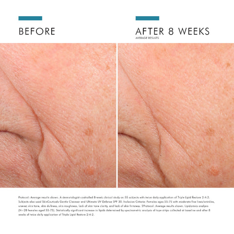 SkinCeuticals Triple Lipid Restore 2:4:2