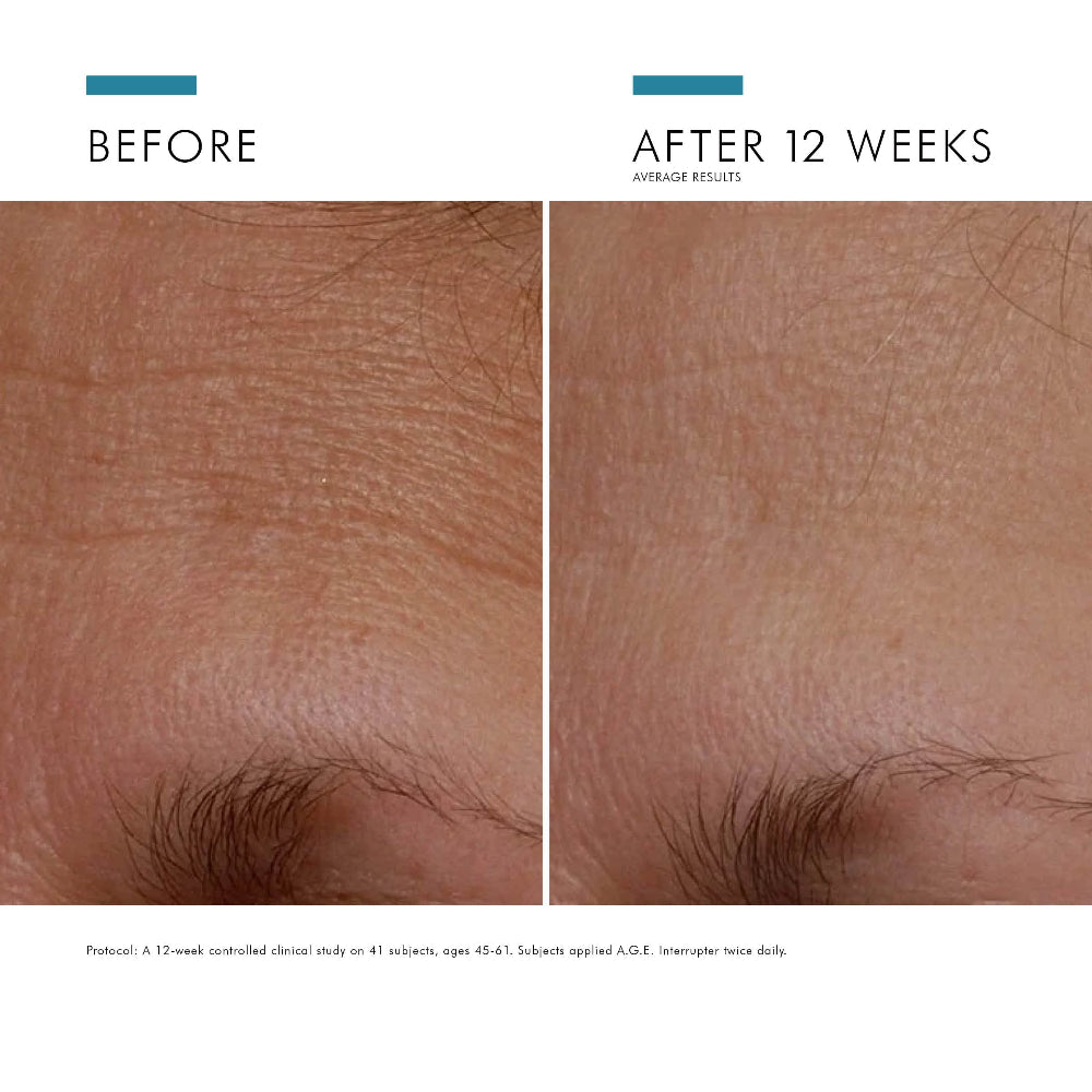 Before and after comparison of skin texture improvement after 12 weeks, showing a clear improvement with SkinCeuticals A.G.E. Interrupter Advanced.