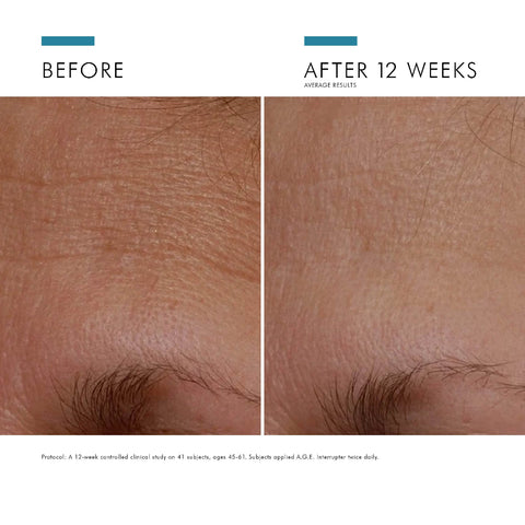Before and after comparison of skin texture improvement after 12 weeks, showing a clear improvement with SkinCeuticals A.G.E. Interrupter Advanced.