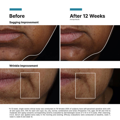 A.G.E. Interrupter Ultra Serum